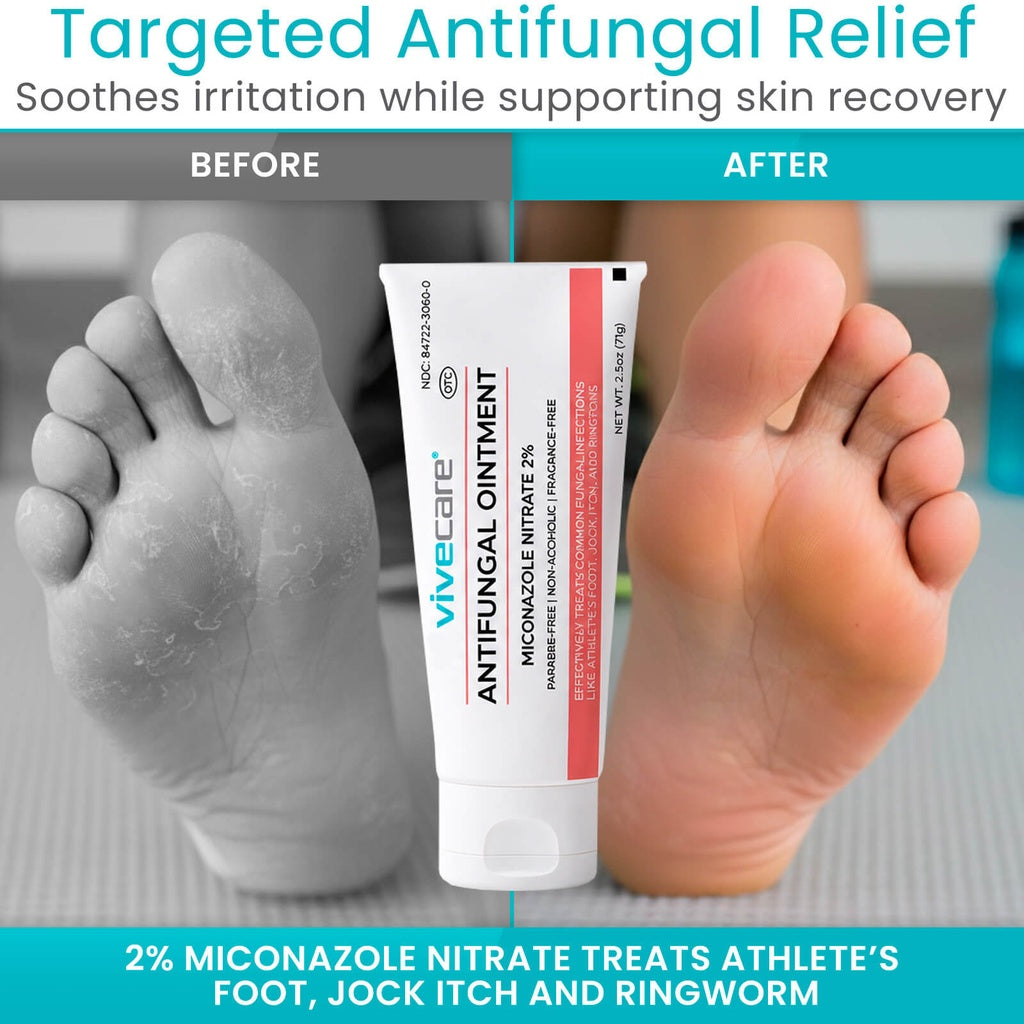 Antifungal Ointment 2% Miconazole Nitrate Vive Care