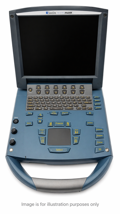 SonoSite P08840-03 Medical Ultrasound/Doppler - Pre-Owned