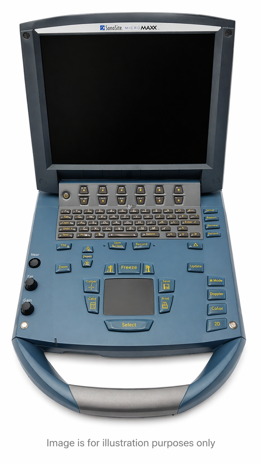 SonoSite P08840-03 Medical Ultrasound/Doppler - Pre-Owned